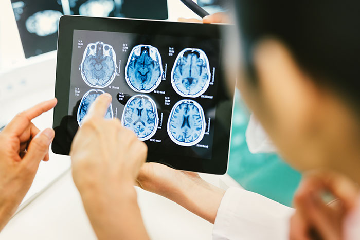 Hands point at brain scan on tablet