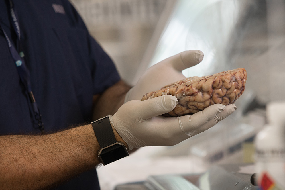 Brain Bank