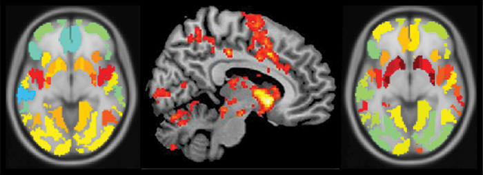 Brain scans