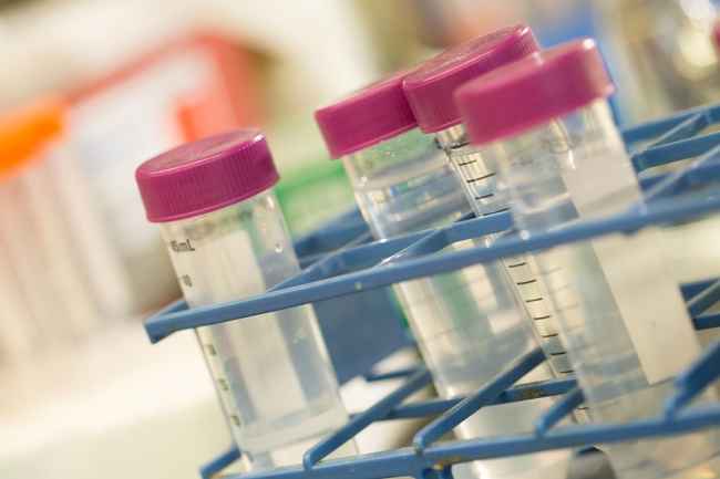 Vials with purple caps in research lab