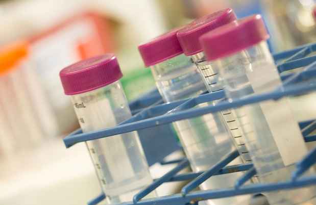 Vials with purple caps in research lab