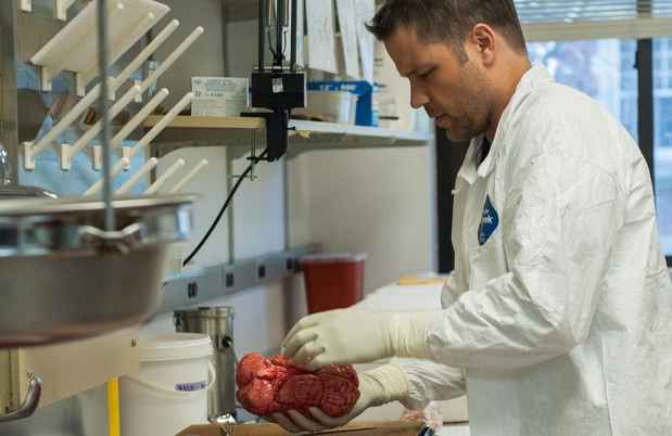 Brain Bank staff prepares a donated brain