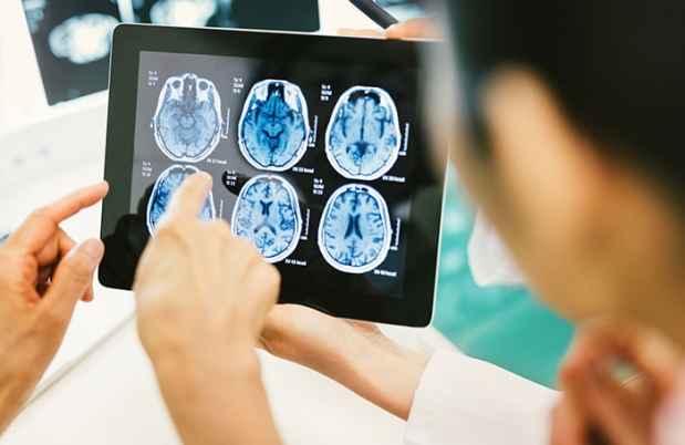 Pointing at brain scan on tablet