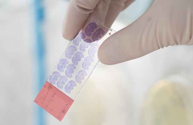 Hand holds microscope slide